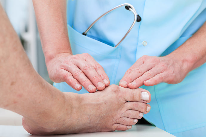 5 Tips for Reducing Bunion Pain